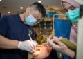How Long Do Dental Fillings Last?