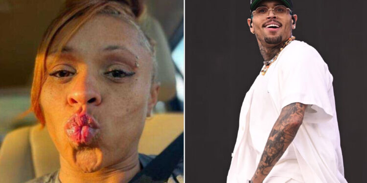 Lytrell Bundy: The True Story of Chris Brown’s Sister