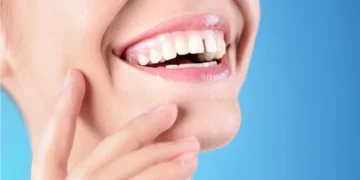More Than a Smile: How Large Tooth Gaps Affect Oral Health and Confidence
