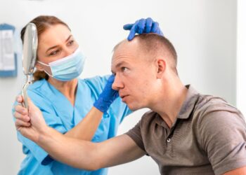 How Many Grafts Are Needed in FUT Hair Transplant?