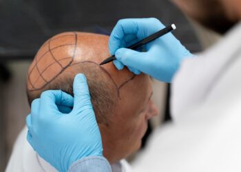 Choosing Experienced Specialists For FUE Hair Transplant In Melbourne