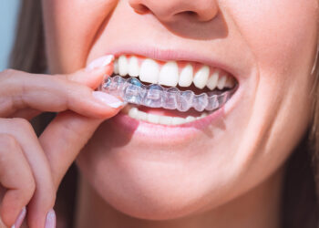 What Happens to Your Oral Health Routine When a Retainer Breaks