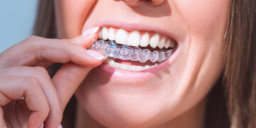 What Happens to Your Oral Health Routine When a Retainer Breaks