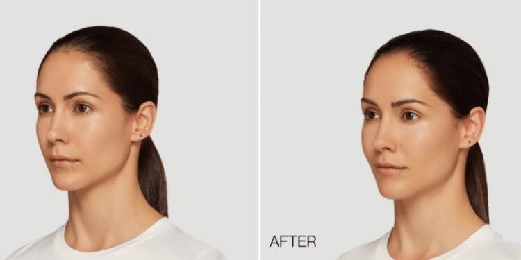 Cosmetic Treatments That Hide Fatigue From Back to Back Video Calls