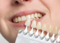 Cosmetic Dentistry