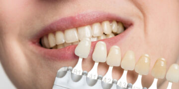 Cosmetic Dentistry