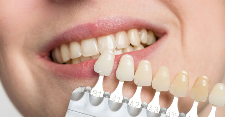 Cosmetic Dentistry