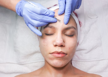 Understanding Acne Treatment Options in Dermatology Clinics