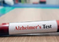 What to Know About Alzheimer’s Blood Biomarkers and Early Brain Health Insight