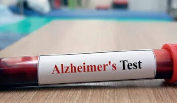 What to Know About Alzheimer’s Blood Biomarkers and Early Brain Health Insight