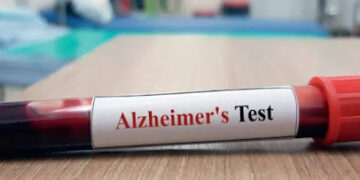 What to Know About Alzheimer’s Blood Biomarkers and Early Brain Health Insight