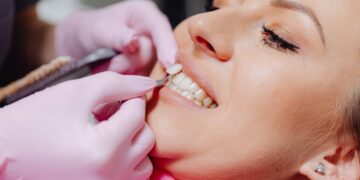 The New Language of Beauty: How Teeth Whitening Technology Is Connecting Smiles, Fashion and Australian Lifestyle Trends