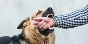 Dog Bite Laws in Texas: