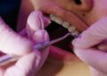 Understanding the Causes of Sensitive Teeth
