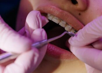 Understanding the Causes of Sensitive Teeth