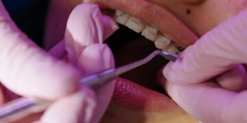 Understanding the Causes of Sensitive Teeth