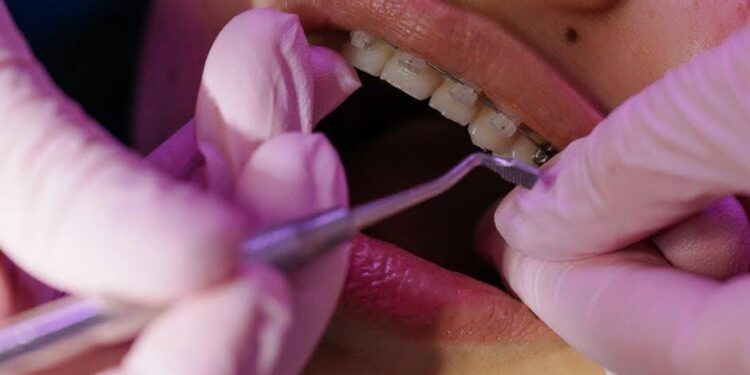 Understanding the Causes of Sensitive Teeth